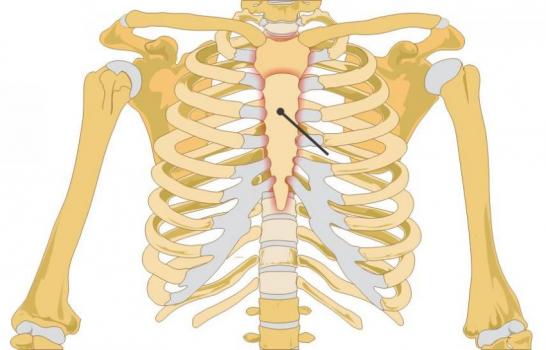 软肋骨炎疼痛位置图图片